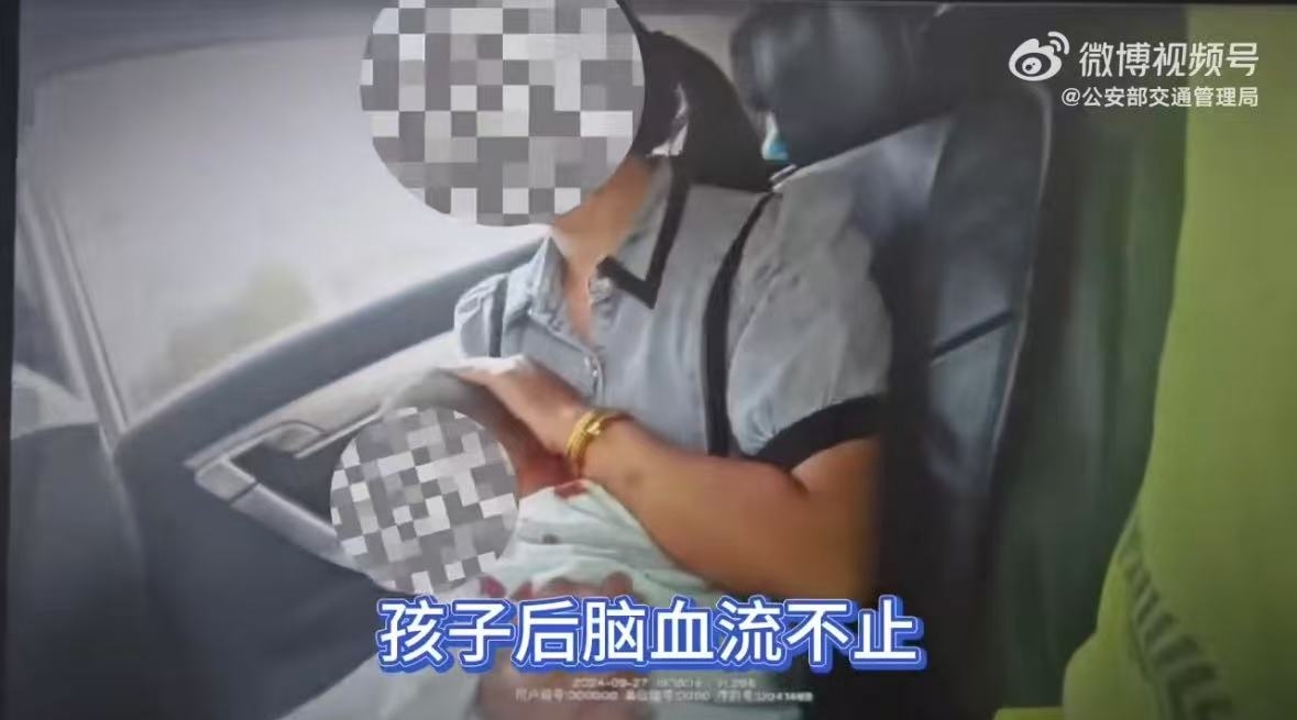 未使用安全座椅 男童头部受伤流血 图片1.jpg